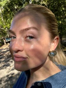 visage injection botox esthetique